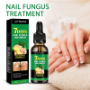 Jaysuing Ginger Nail Care Solution, Hand, Foot And Nail Care Soft Nail Shine Moisturizer Gray Nails