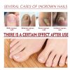 Jaysuing Nail Care Oil Soft Nail Brightening Nail Inlay Thickening Grey Nail Care Oil